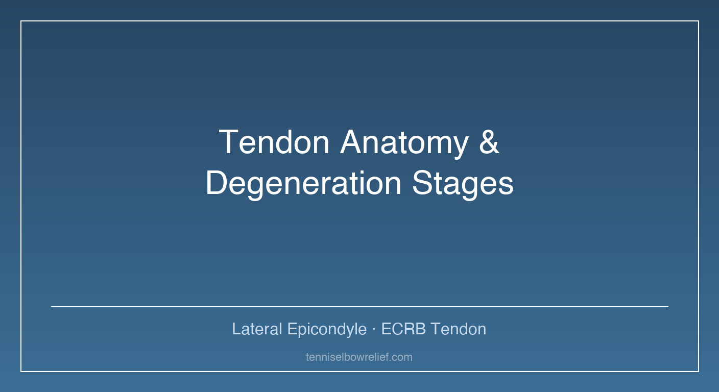 Medical infographic showing the anatomy of the lateral epicondyle and common extensor tendon with labeled stages of tendon degeneration from healthy tissue to angiofibroblastic hyperplasia