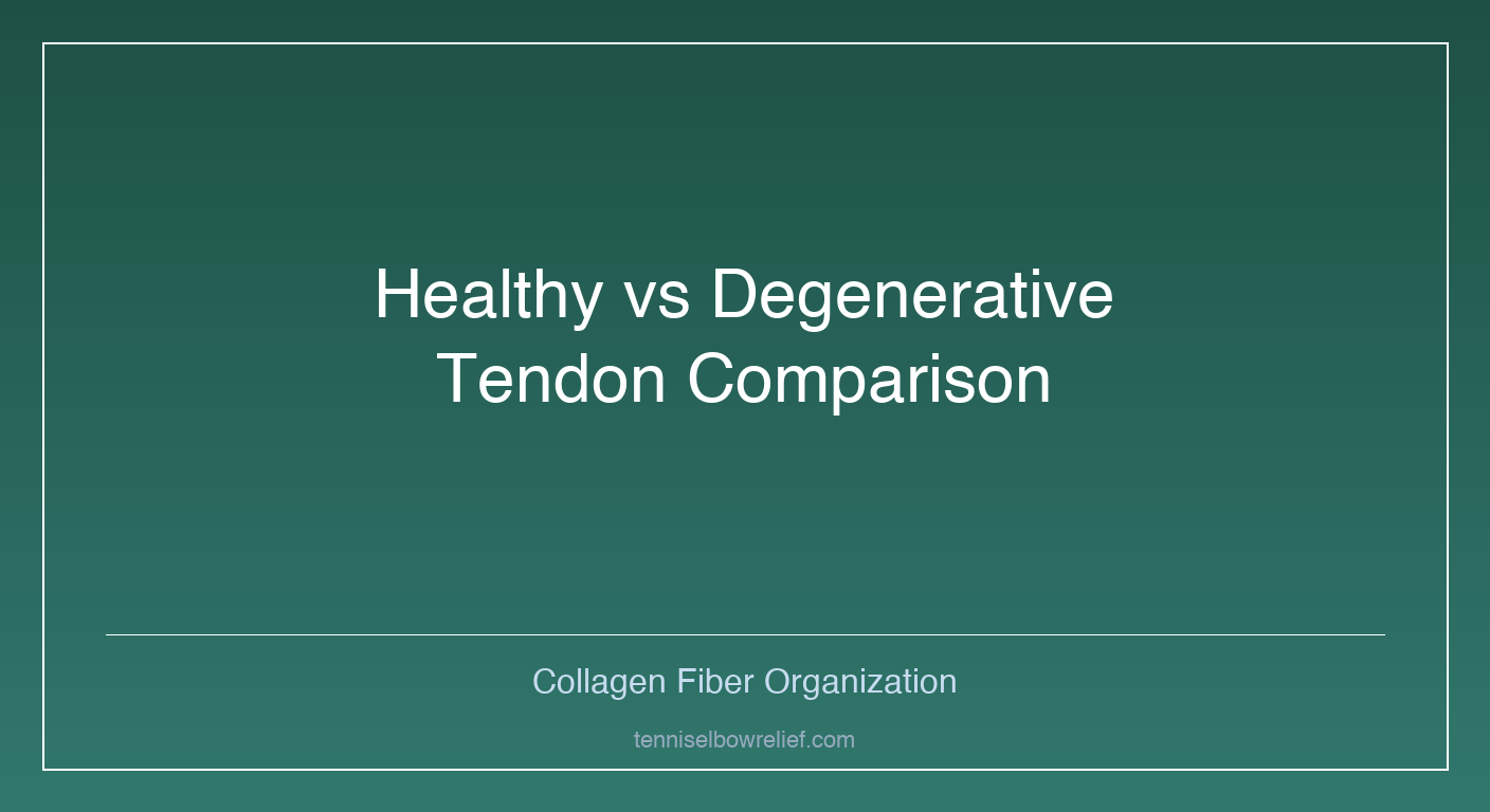 Cross-sectional diagram of a healthy tendon versus a degenerative tendon showing collagen fiber disorganization and neovascularization